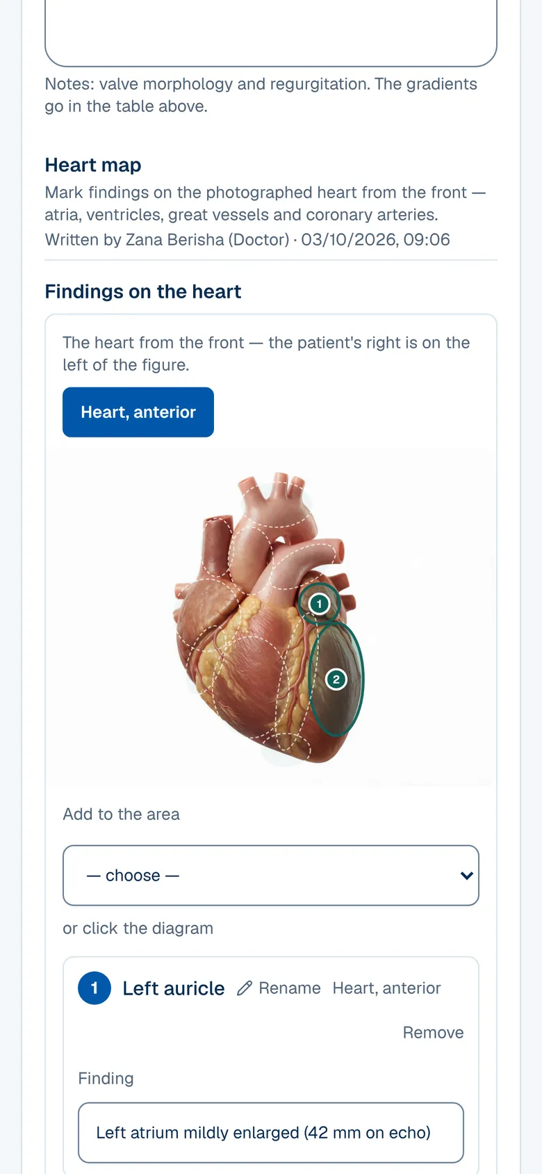 The Cardiology screen in OPALEVI