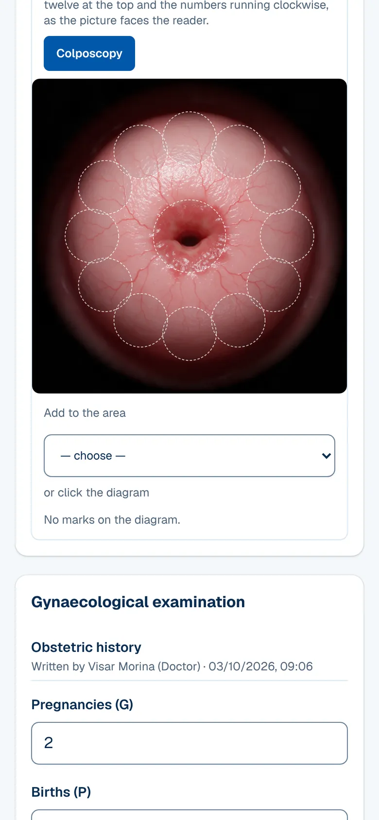 The Gynaecology screen in OPALEVI